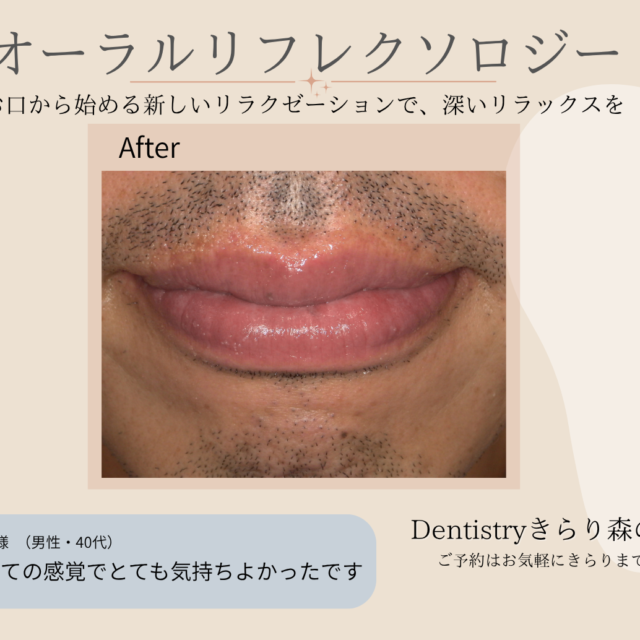 エステ