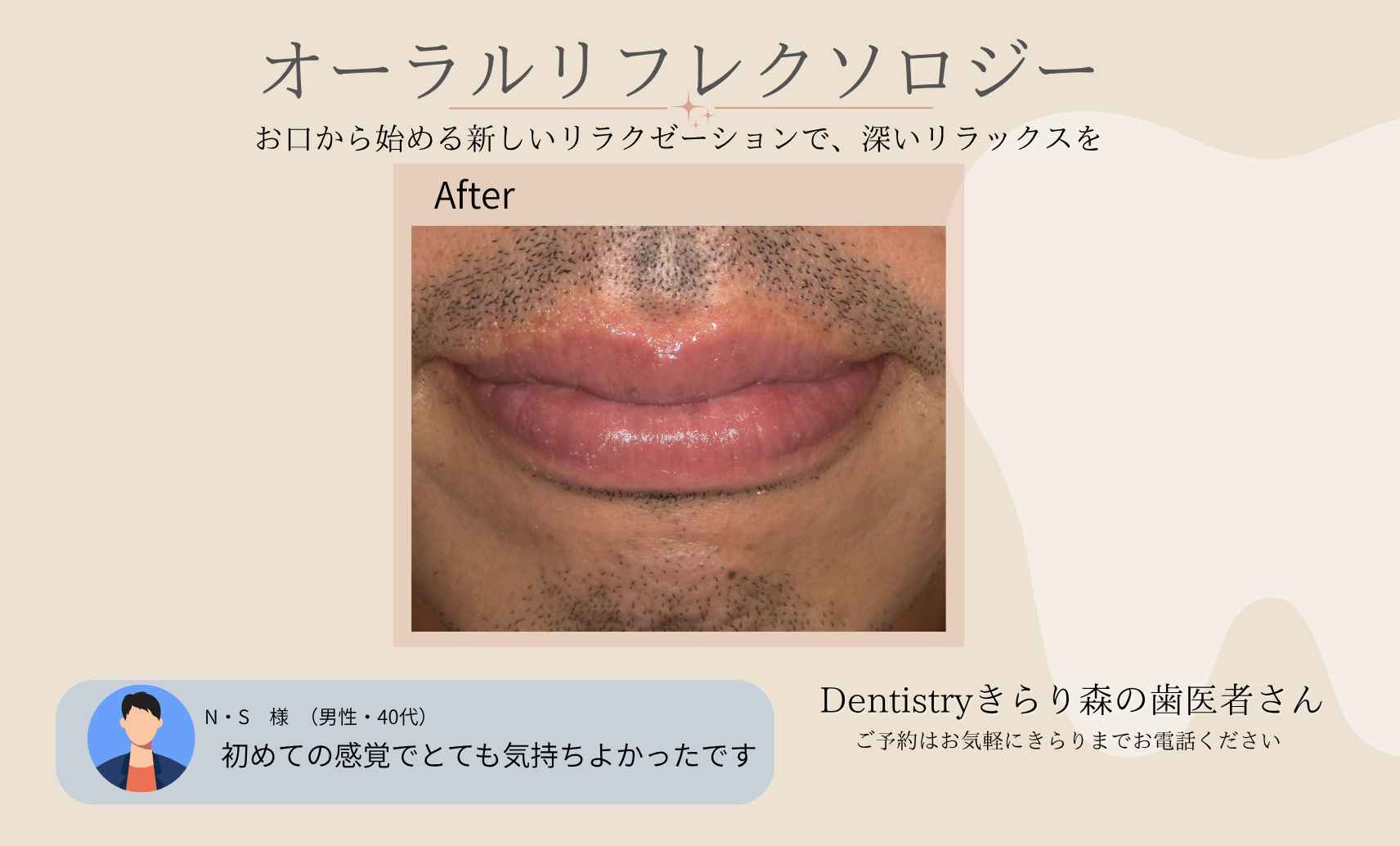 エステ